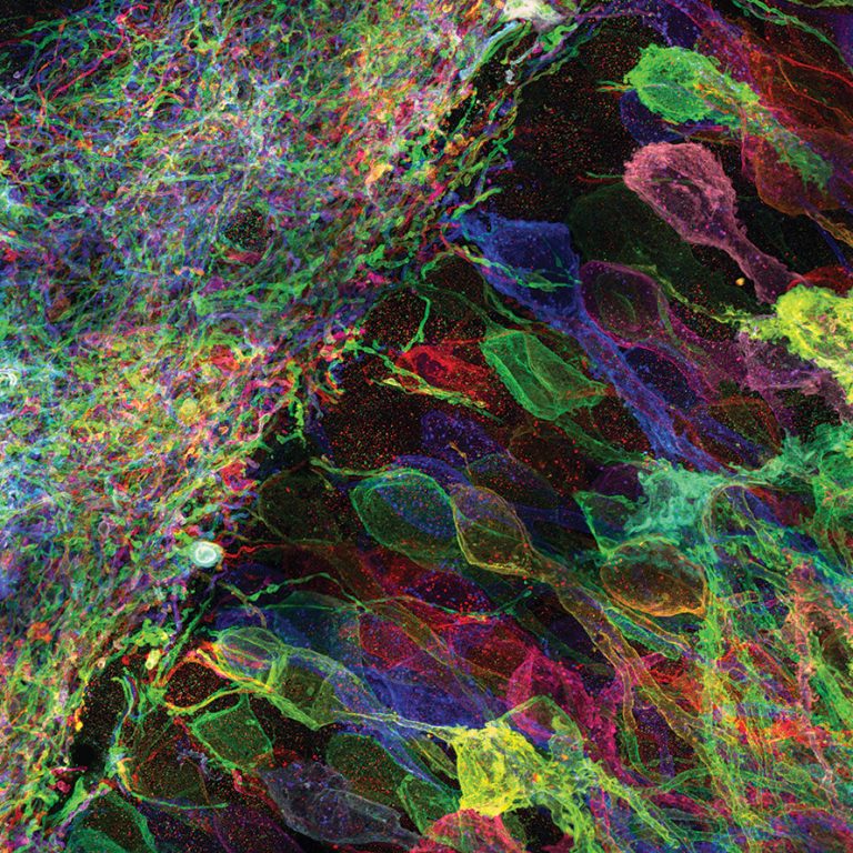 D25 Dana Farber Polizzi